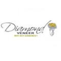 diamond-veneer-coupons